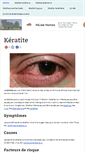 Mobile Screenshot of keratite.com