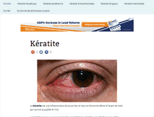 Tablet Screenshot of keratite.com